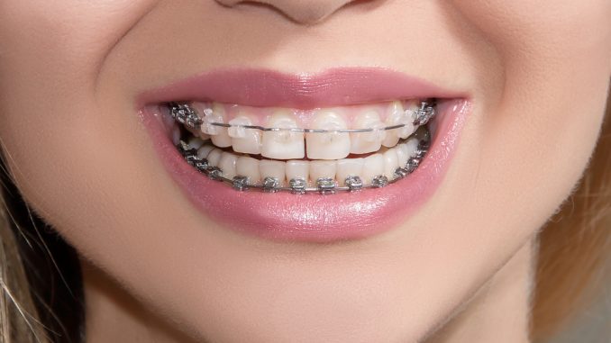 Quick guide to the services of an orthodontist